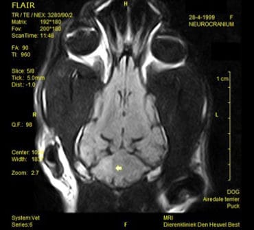 MRI-HOND