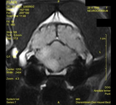 MRI-HOND