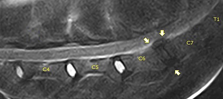 CT-MRI-HOND