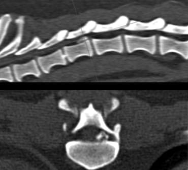 CT-MRI-nek-rug