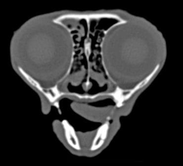 CT-MRI-neus