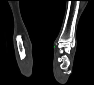 CT-MRI-OCD